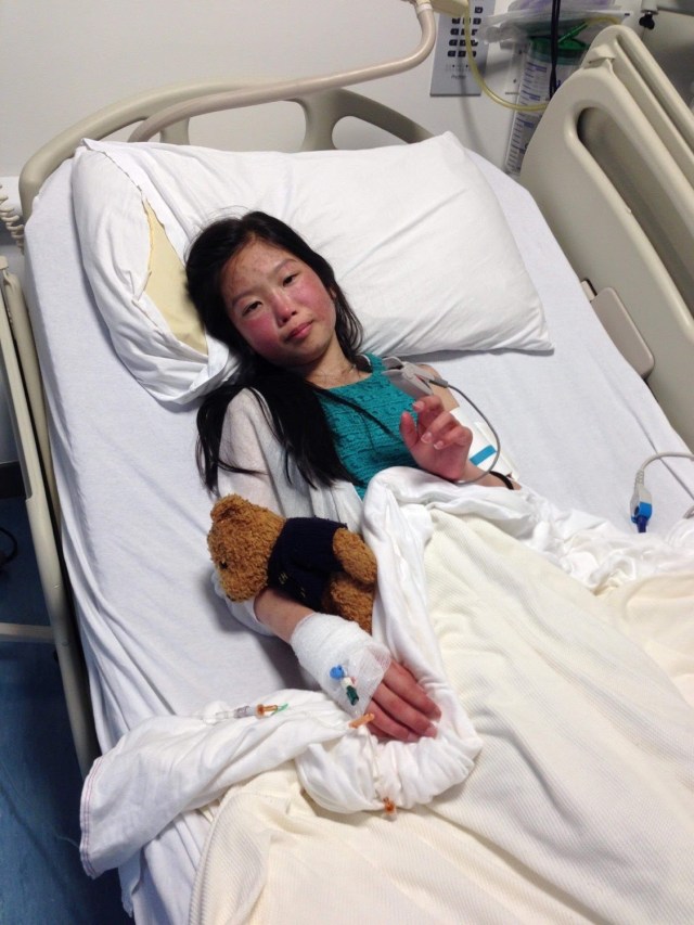 What is Lupus? - Behind the Scenes of Someone with a Chronic Illness and Disability 3 Lupus article image